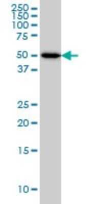 Western Blot: ADPGK Antibody (1E4) [H00083440-M01]