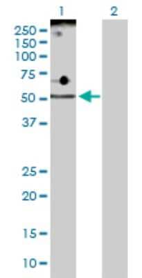 Western Blot: ADPGK Antibody [H00083440-D01P]