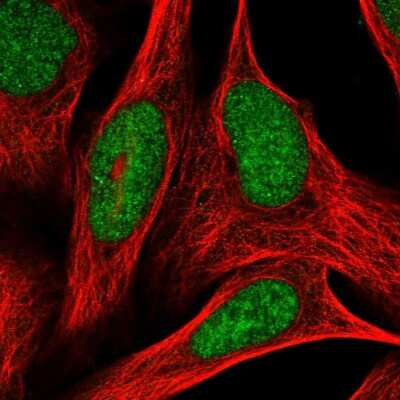 Immunocytochemistry/ Immunofluorescence: ADPRHL2 Antibody [NBP1-88834]
