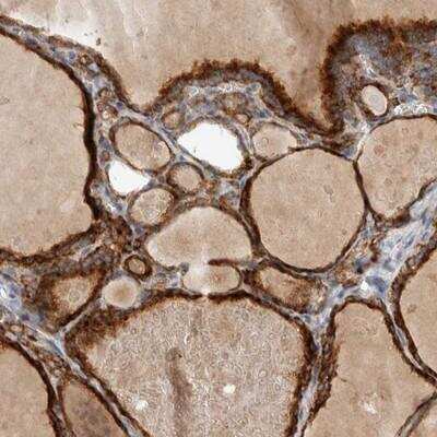 Immunohistochemistry-Paraffin: ADPRM Antibody [NBP1-81246]