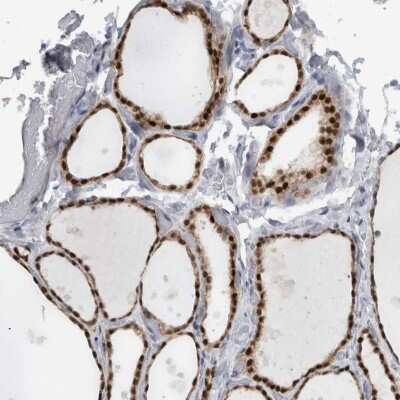 Immunohistochemistry-Paraffin: ADPRM Antibody [NBP1-81247]