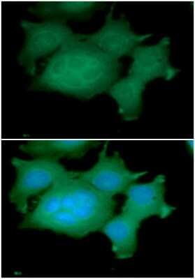 Immunocytochemistry/ Immunofluorescence: ADRM1 Antibody (34C2) - BSA Free [NBP2-59402]