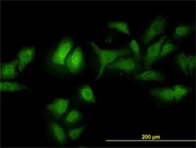 Immunocytochemistry/ Immunofluorescence: ADRM1 Antibody (3C6) [H00011047-M01]