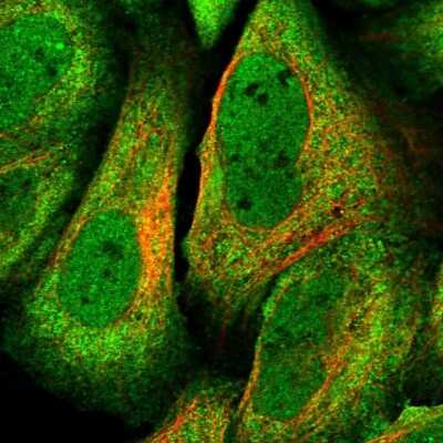 Immunocytochemistry/ Immunofluorescence: ADRM1 Antibody [NBP1-88993]