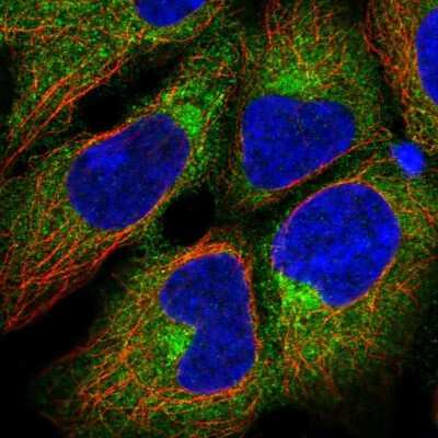 Immunocytochemistry/ Immunofluorescence: ADTB1 Antibody [NBP2-57109]