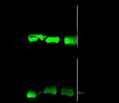 Immunoprecipitation: ADTB1 Antibody [NBP2-99079]