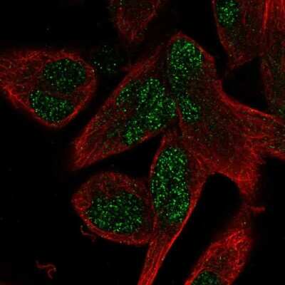 Immunocytochemistry/ Immunofluorescence: AEBP2 Antibody [NBP2-30712]