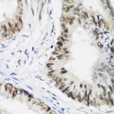 Immunohistochemistry-Paraffin: AEBP2 Antibody - BSA Free [NBP2-92913]
