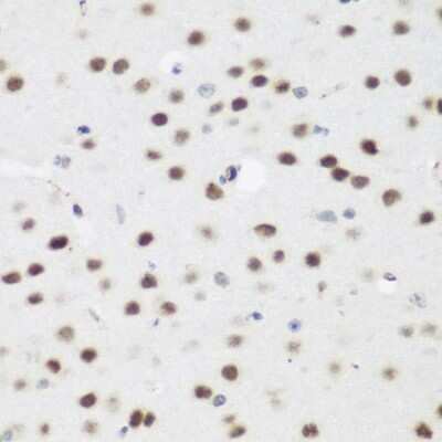 Immunohistochemistry-Paraffin: AEBP2 Antibody - BSA Free [NBP2-92913]