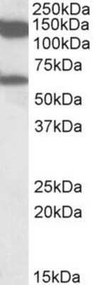 Western Blot: AF10 Antibody [NBP1-49867]