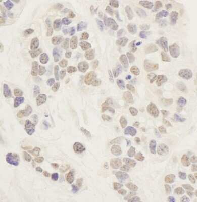 Immunohistochemistry-Paraffin: AF4 Antibody [NBP1-28728]