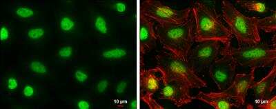 Immunocytochemistry/ Immunofluorescence: AF9 Antibody [NBP2-15303]