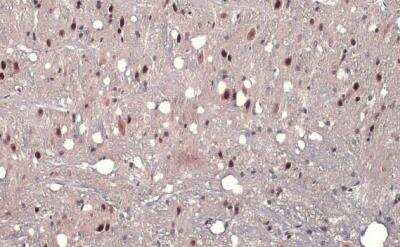 Immunohistochemistry-Paraffin: AF9 Antibody [NBP2-15303]
