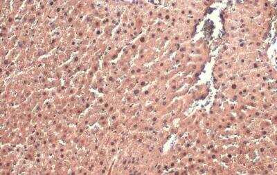 Immunohistochemistry-Paraffin: AF9 Antibody [NBP2-15303]