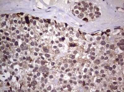 Immunohistochemistry: AFAP Antibody (OTI2G9) [NBP2-46498]