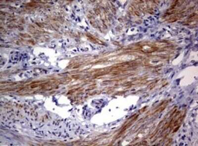 Immunohistochemistry: AFAP Antibody (OTI2G9) [NBP2-46498]