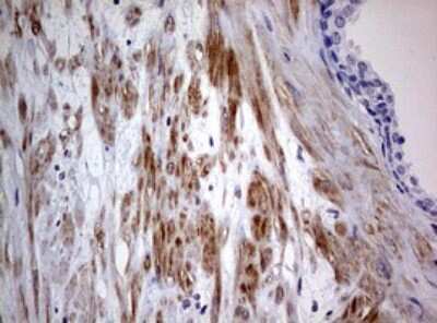 Immunohistochemistry: AFAP Antibody (OTI2G9) [NBP2-46498]