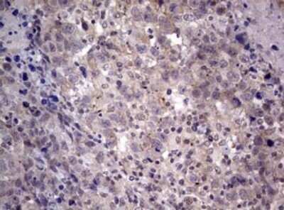 Immunohistochemistry: AFAP Antibody (OTI2G9) - Azide and BSA Free [NBP2-72120]