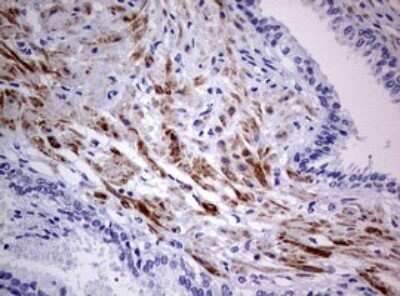 Immunohistochemistry: AFAP Antibody (OTI2G9) - Azide and BSA Free [NBP2-72120]