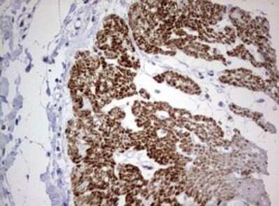 Immunohistochemistry: AFAP Antibody (OTI2G9) - Azide and BSA Free [NBP2-72120]