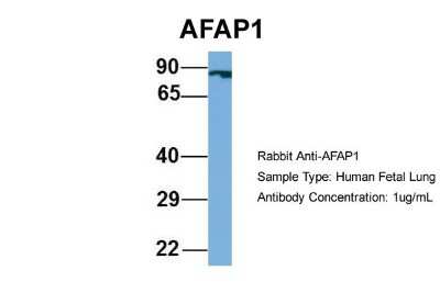Western Blot: AFAP Antibody [NBP1-56581]