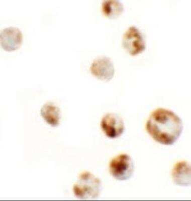 Immunocytochemistry/ Immunofluorescence: AFAP1L1 Antibody - BSA Free [NBP2-81889]