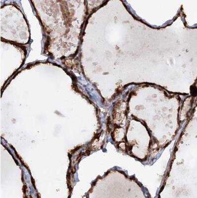 Immunohistochemistry-Paraffin: AFAP1L2 Antibody [NBP1-84859]