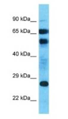 Western Blot: AFDN-DT Antibody [NBP3-09222]