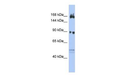 Western Blot: AFF2 Antibody [NBP2-84403]
