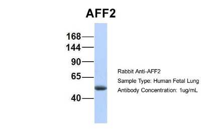 Western Blot: AFF2 Antibody [NBP2-84403]