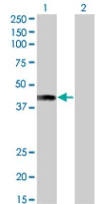 Western Blot: AFF4 Antibody (2E12) [H00027125-M01]