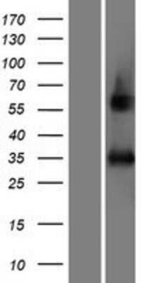 Western Blot: AFMID Overexpression Lysate [NBP2-08777]