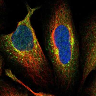 Immunocytochemistry/ Immunofluorescence: AFTPH Antibody [NBP1-82209]
