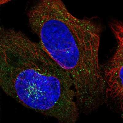 Immunocytochemistry/ Immunofluorescence: AFTPH Antibody [NBP2-38227]