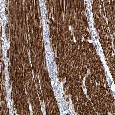 Immunohistochemistry-Paraffin: AFTPH Antibody [NBP1-82209]