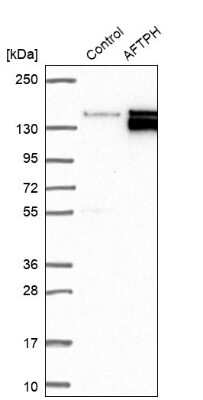 Western Blot: AFTPH Antibody [NBP1-82209]