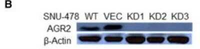 Western Blot: AG-2/AGR2 AntibodyAzide Free [NBP2-27392]