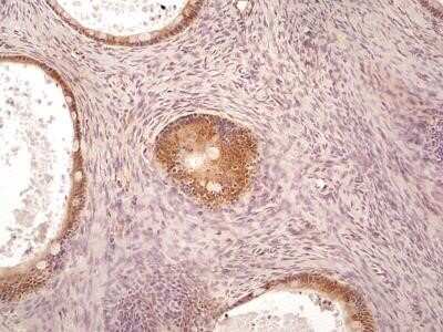 Immunohistochemistry: AG-2/AGR2 Antibody (10E2) - Azide and BSA Free [NBP2-80564]