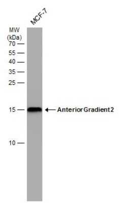 Western Blot: AG-2/AGR2 Antibody (GT5812) [NBP3-13593]