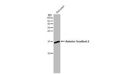 Western Blot: AG-2/AGR2 Antibody (HL1024) [NBP3-13684]