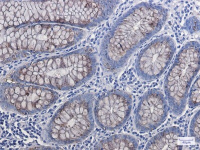 Immunohistochemistry-Paraffin: AG-2/AGR2 Antibody (S04-1H6) [NBP3-19534]