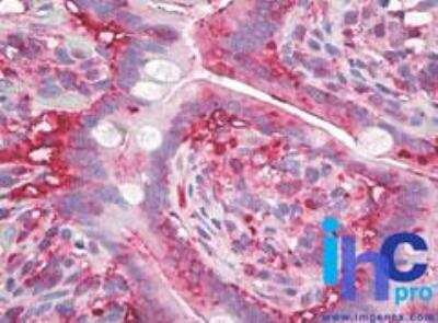 Immunohistochemistry-Paraffin: AG-2/AGR2 Antibody (10E2) - BSA Free [NBP2-27175]