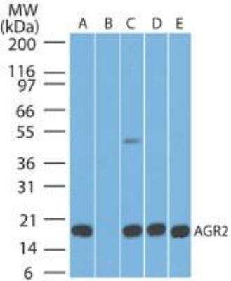 Western Blot: AG-2/AGR2 Antibody (10E2)BSA Free [NBP2-27175]