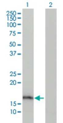 Western Blot: AG-2/AGR2 Antibody (1C3) [H00010551-M03]