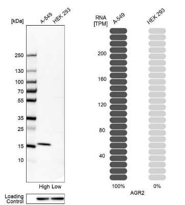 Western Blot: AG-2/AGR2 Antibody [NBP1-89212]