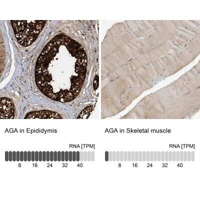 Immunohistochemistry-Paraffin: AGA Antibody [NBP1-88866]