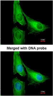 Immunocytochemistry/ Immunofluorescence: AGAP1 Antibody [NBP1-31261]