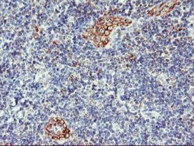 Immunohistochemistry: AGAP1 Antibody (OTI4E8) - Azide and BSA Free [NBP2-72357]