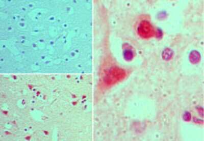 Immunohistochemistry-Paraffin: AGAP2 Antibody [NBP2-24498]