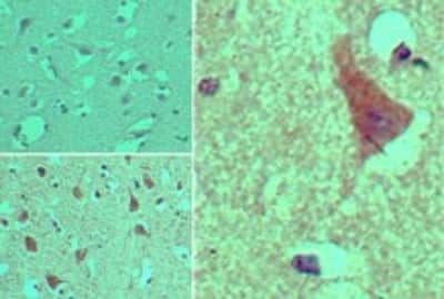 Immunohistochemistry-Paraffin: AGAP2 Antibody [NBP2-24554]